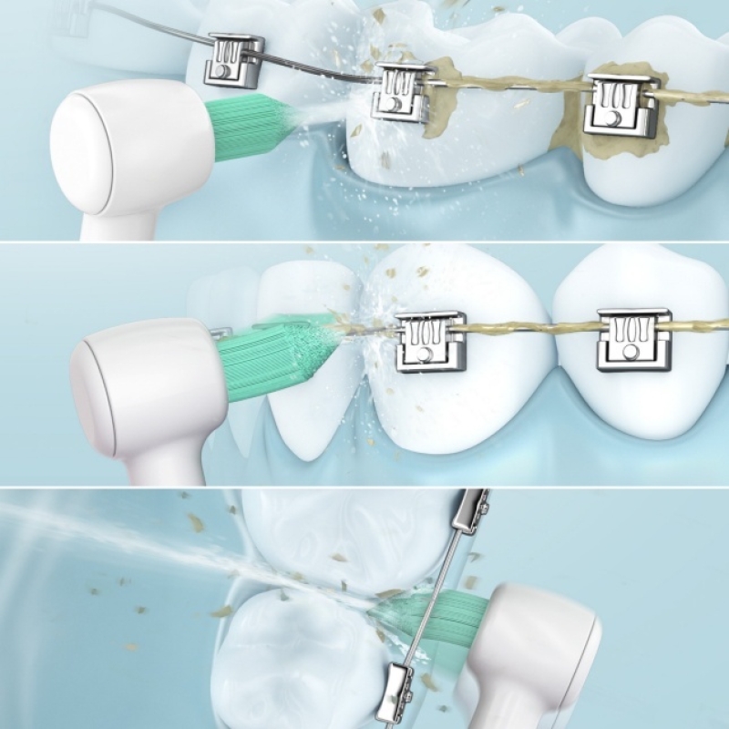 Máy Tăm Nước Panasonic EW1513 - Thế Hệ Mới - Bảo Hành Chính Hãng - Công Nghệ Siêu Âm - Làm Sạch Răng Nướu, Chỉnh Nha